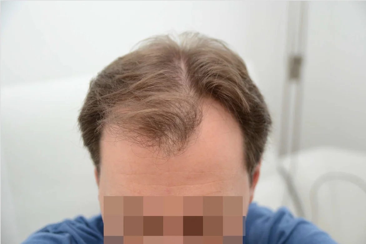 Before photo