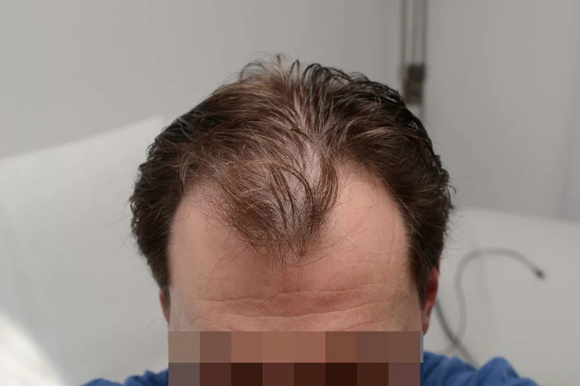 Before photo