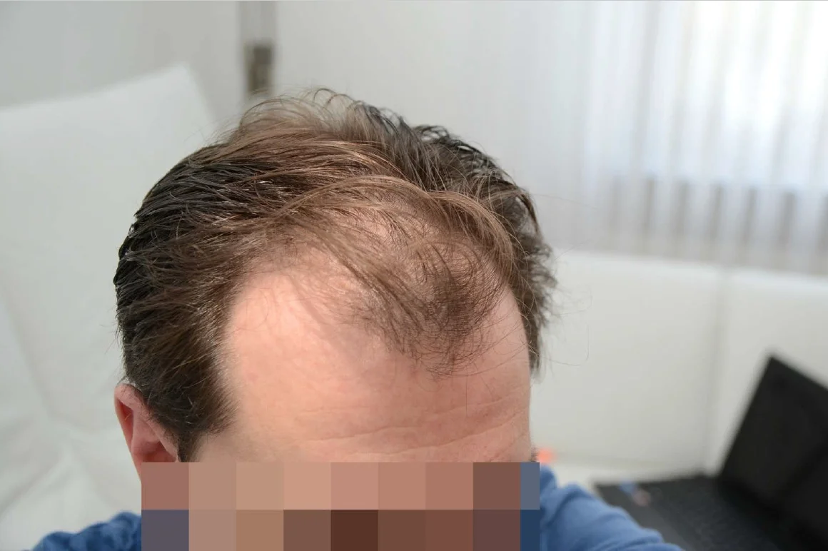Before photo