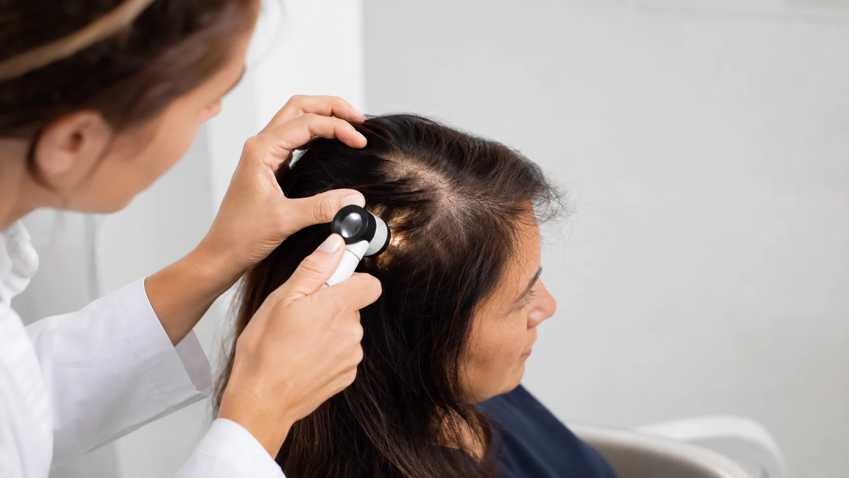 Does DHT Cause Hair Loss in Women?